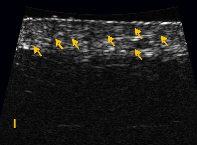 The High Frequency (HF) Ultrasound as a Useful Imaging Technique for ...