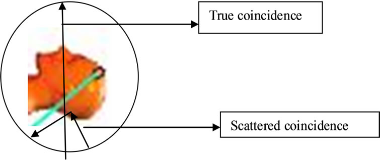 A Review of Epilepsy Diagnosis Using PET Parameters