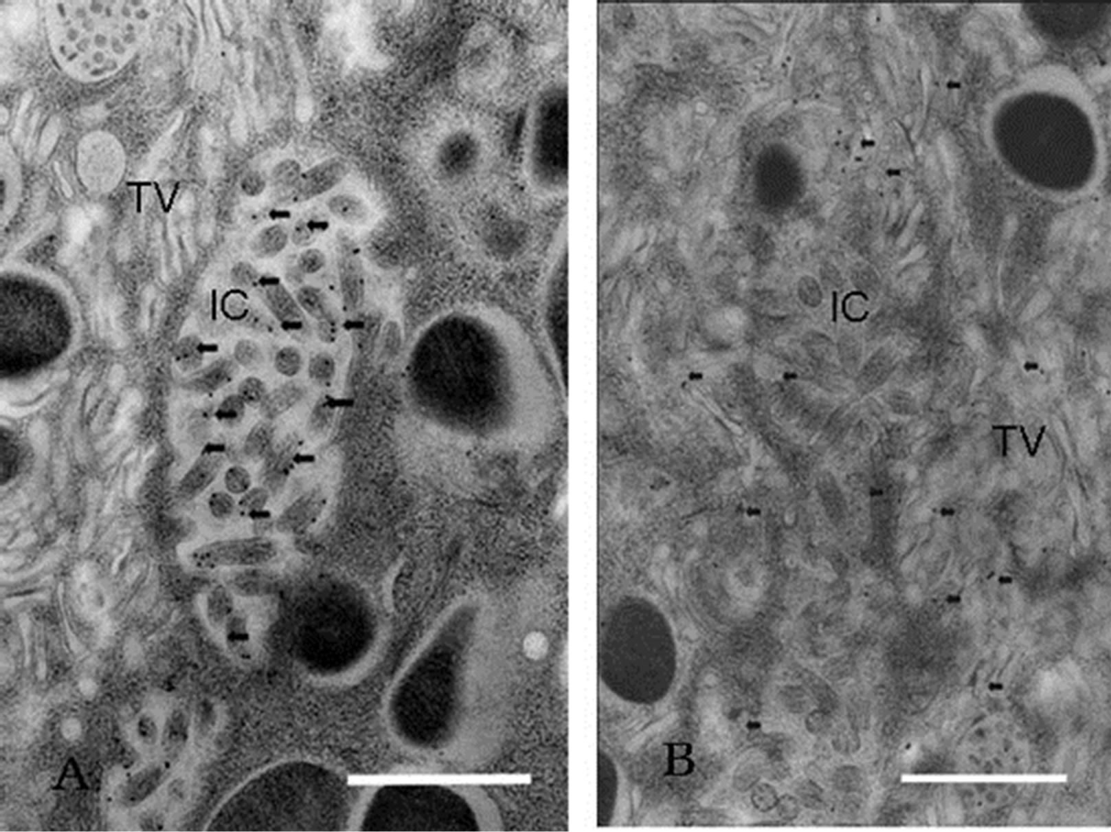 Immunohistochemical Analysis of the Acid Secretion Potency in Gastric