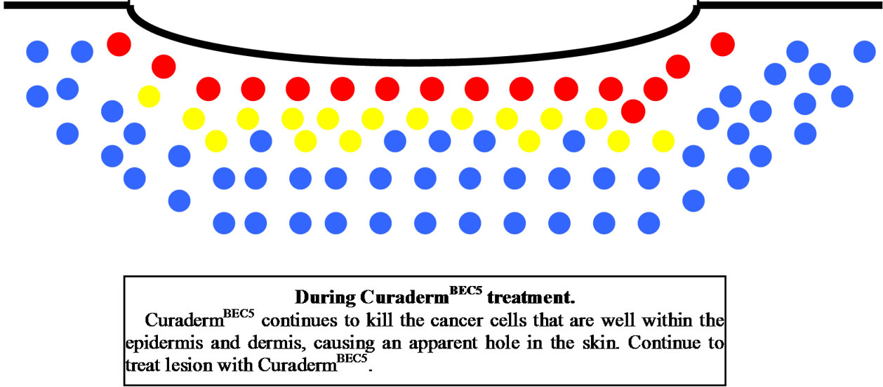 Curaderm Side Effects