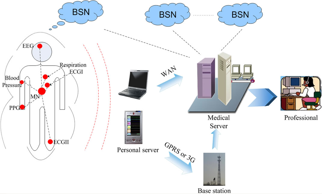 MobiHealthcare System Body Sensor Network Based MHealth System for
