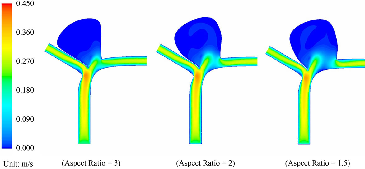 Influence of the aspect ratio on the endovascular treatment of ...