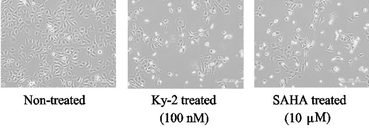 Novel histone deacetylase inhibitor exhibits antitumor activity via ...