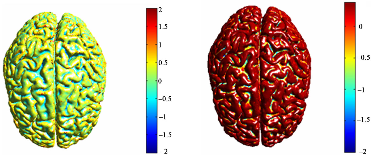 Characterization of a human brain cortical surface mesh using discrete ...