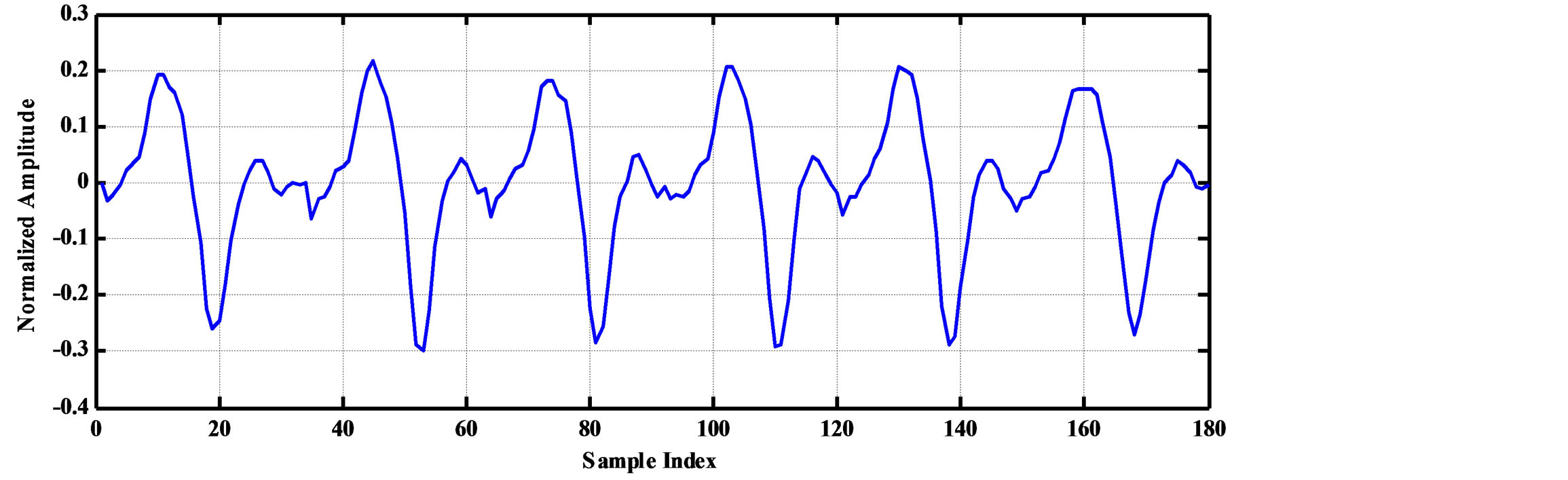 Compression of ECG Signals Based on DWT and Exploiting the Correlation ...