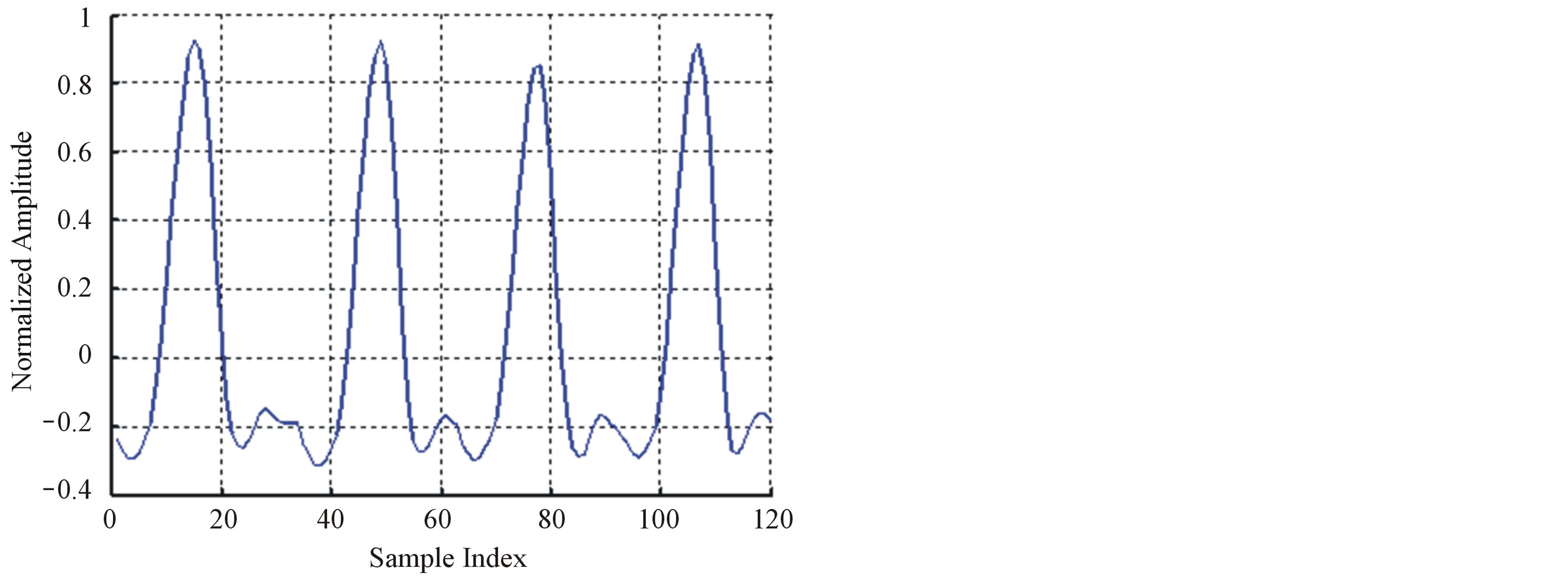 Compression of ECG Signals Based on DWT and Exploiting the Correlation ...