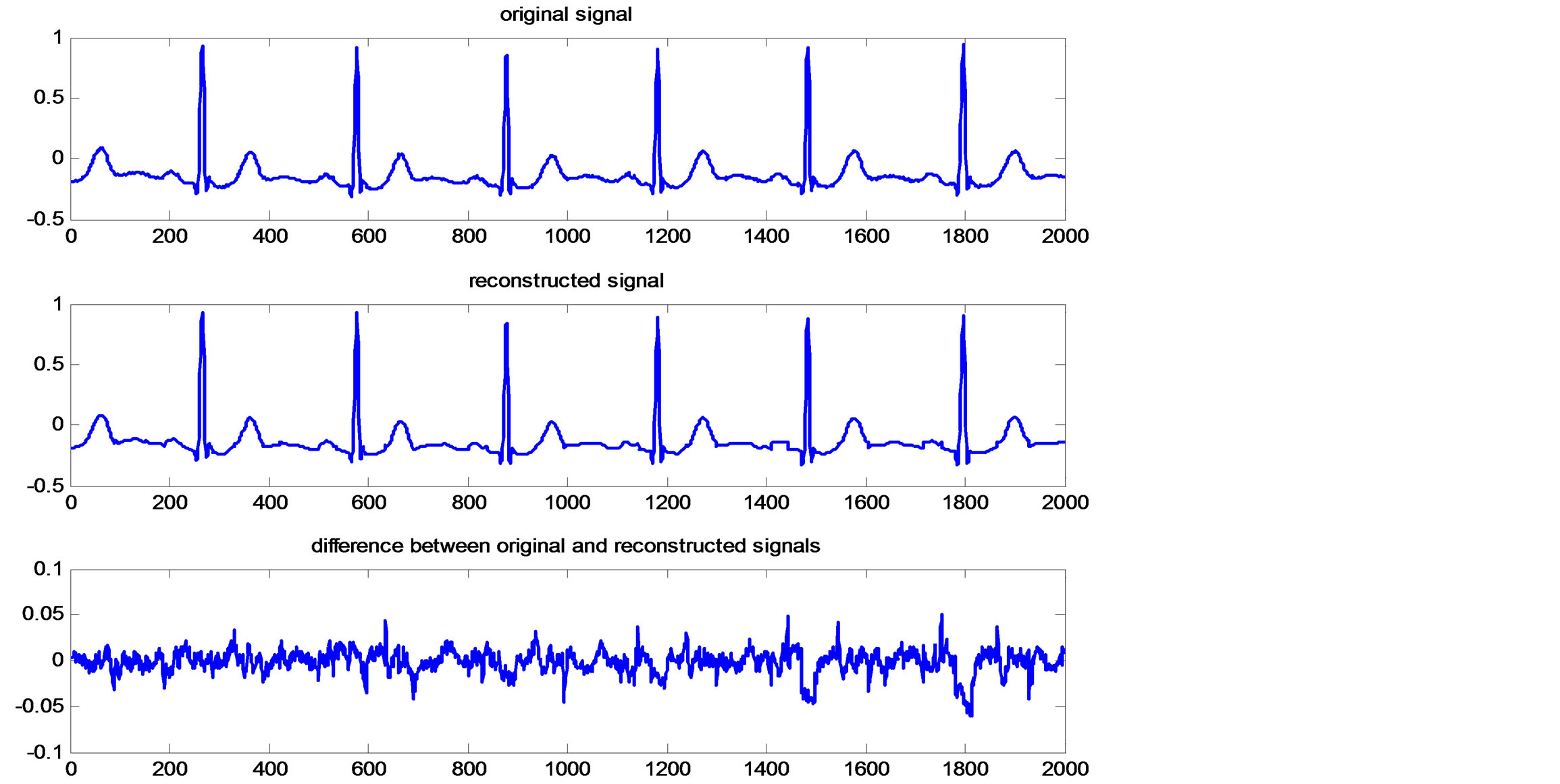 Compression of ECG Signals Based on DWT and Exploiting the Correlation ...