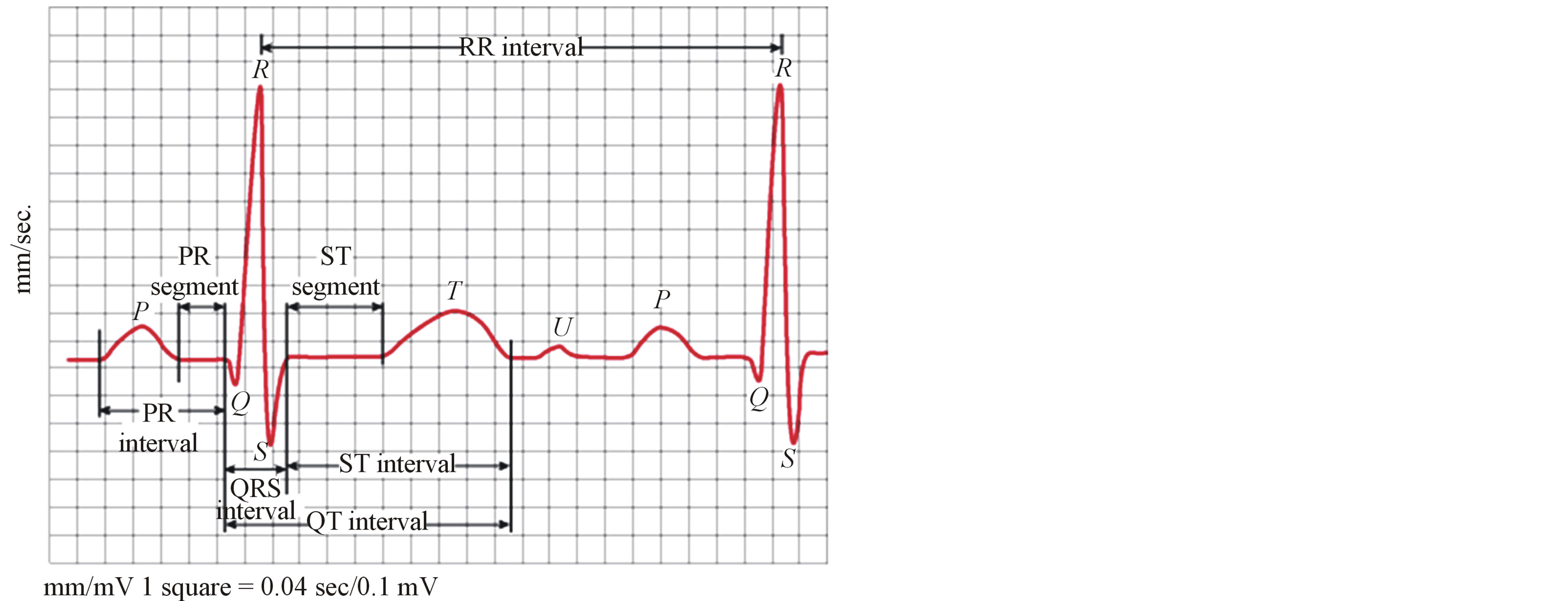 Compression of ECG Signals Based on DWT and Exploiting the Correlation ...