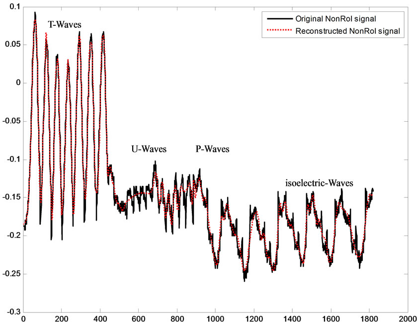 Compression of ECG Signals Based on DWT and Exploiting the Correlation ...
