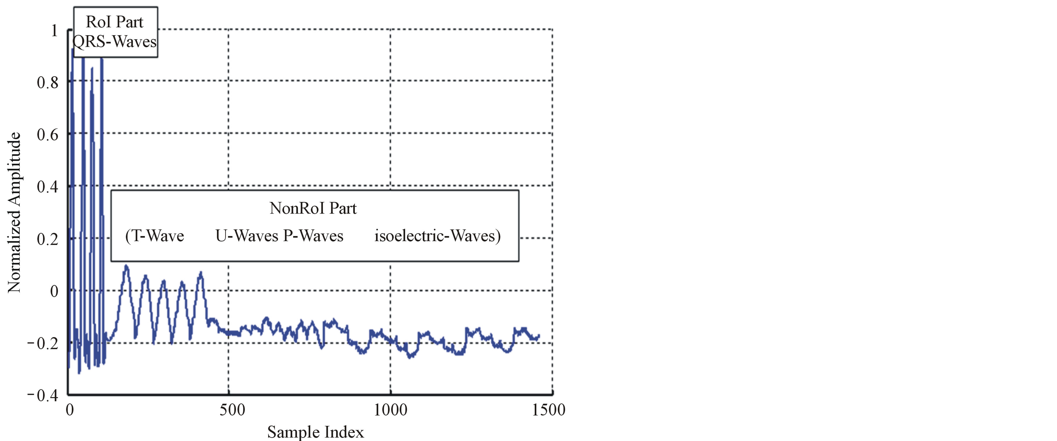 Compression of ECG Signals Based on DWT and Exploiting the Correlation ...