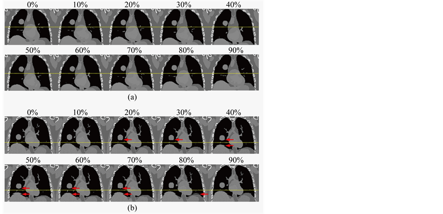 An Integrated Simulation System Based on Digital Human Phantom for 4D ...