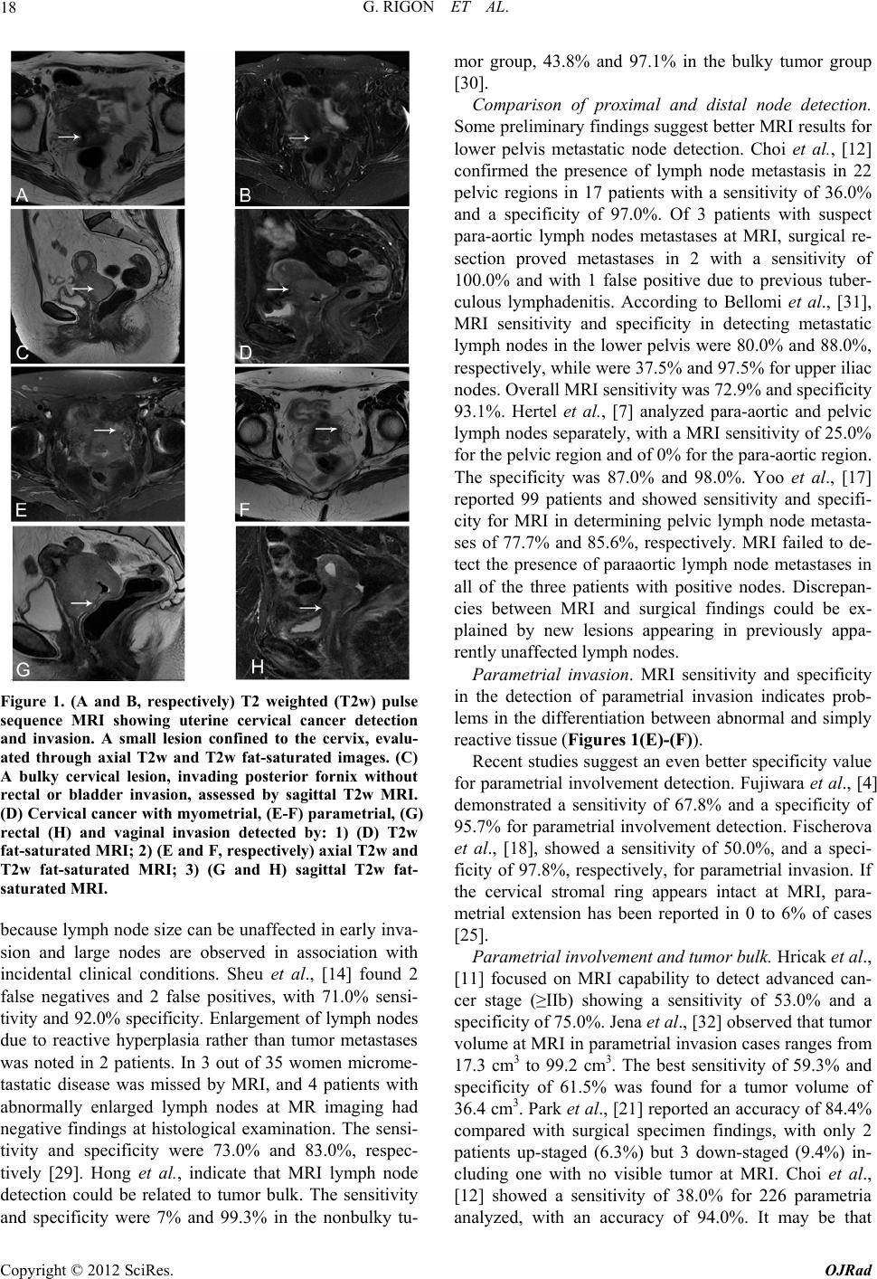 Diagnostic Accuracy of MRI in Primary Cervical Cancer