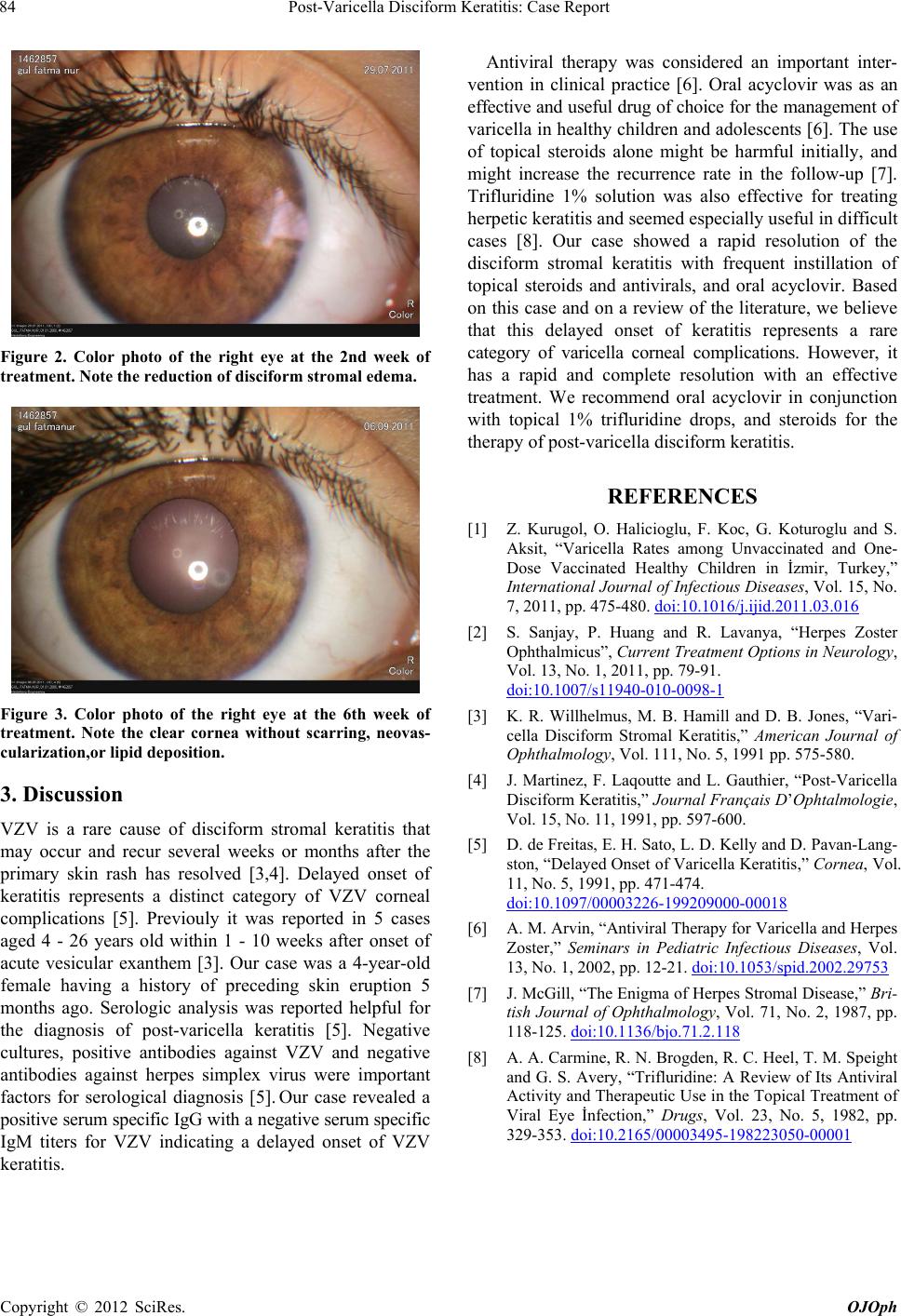 PostVaricella Disciform Keratitis Case Report