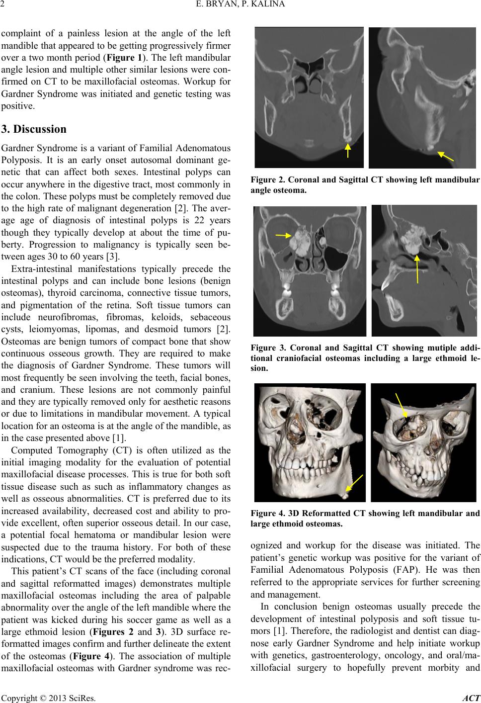 Mutations in AXIN2 Cause Familial Tooth Agenesis and Predispose to  Colorectal Cancer: The American Journal of Human Genetics, image size:968x1414