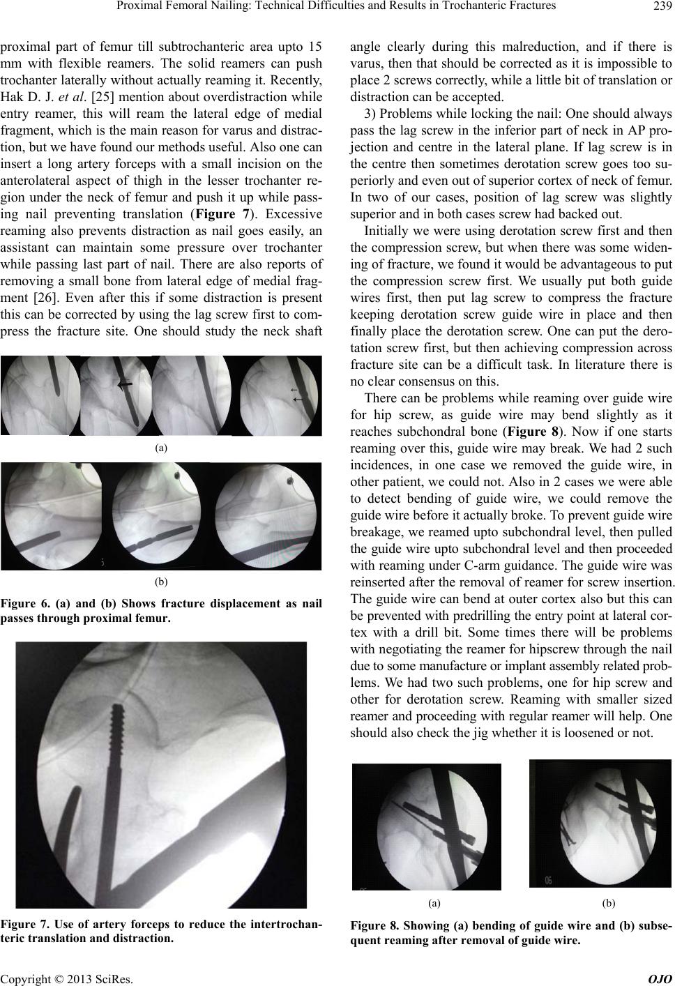 a) Sliding hip screw for intertrochanteric fracture. (b)... | Download  Scientific Diagram