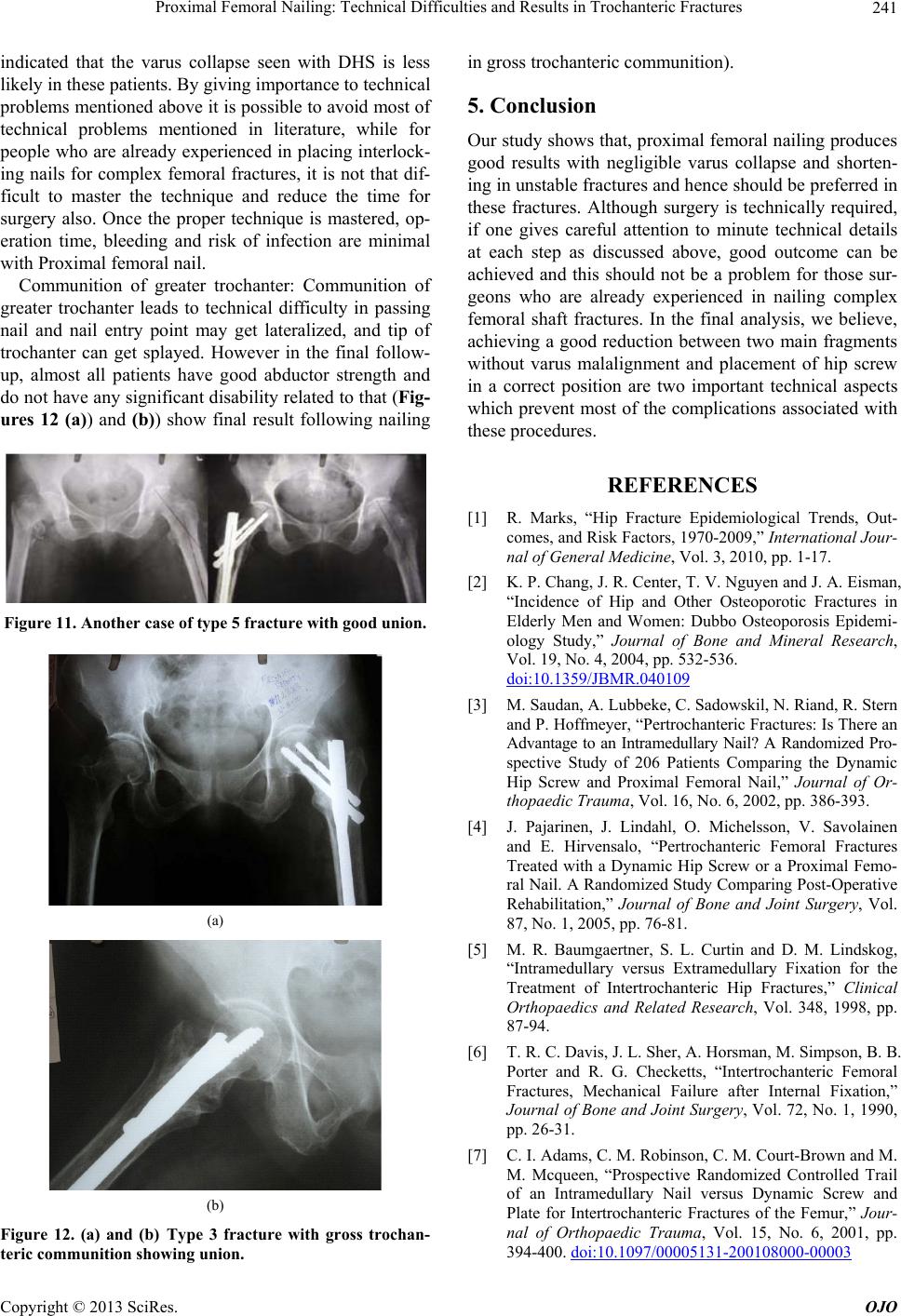 Proximal Femoral Nailing: Technical Difficulties and Results in Trochanteric  Fractures