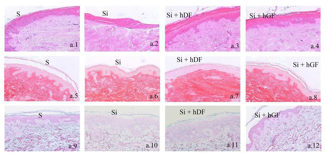 Inhibition of elastin and collagen networks degradation in human skin ...